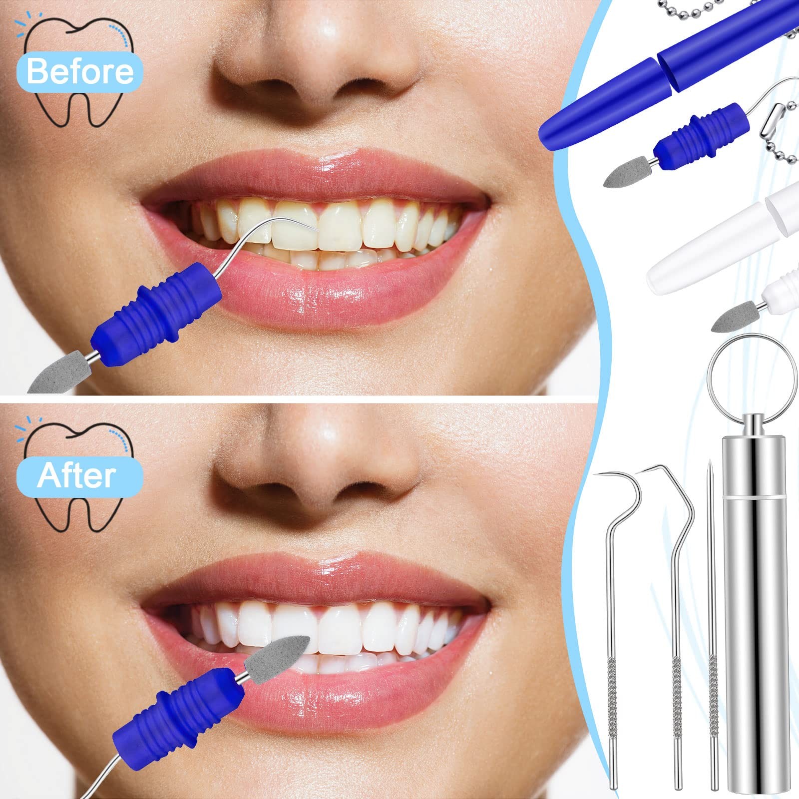 Honeydak 5 Pieces Dental Tools Travel as pictures shown, shown