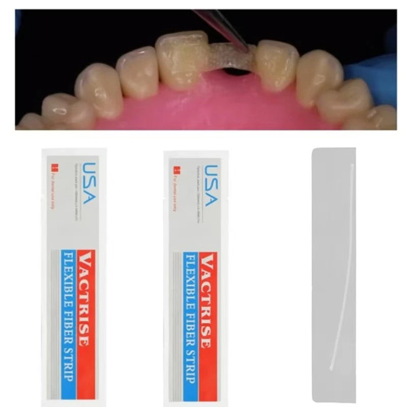 Dental Glass Fiber Splint Composite Resin Bonding Ribbon Flexible Fiber Strips