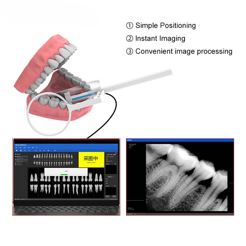 1 Year Warranty Dental RVG Sensor High-Frequency Digital Sensor Dentist HD Image