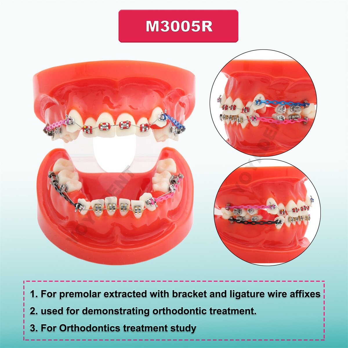 Dental Typodont Teeth Model Orthodontic Treatment Metal Ceramic BracketsRetainer