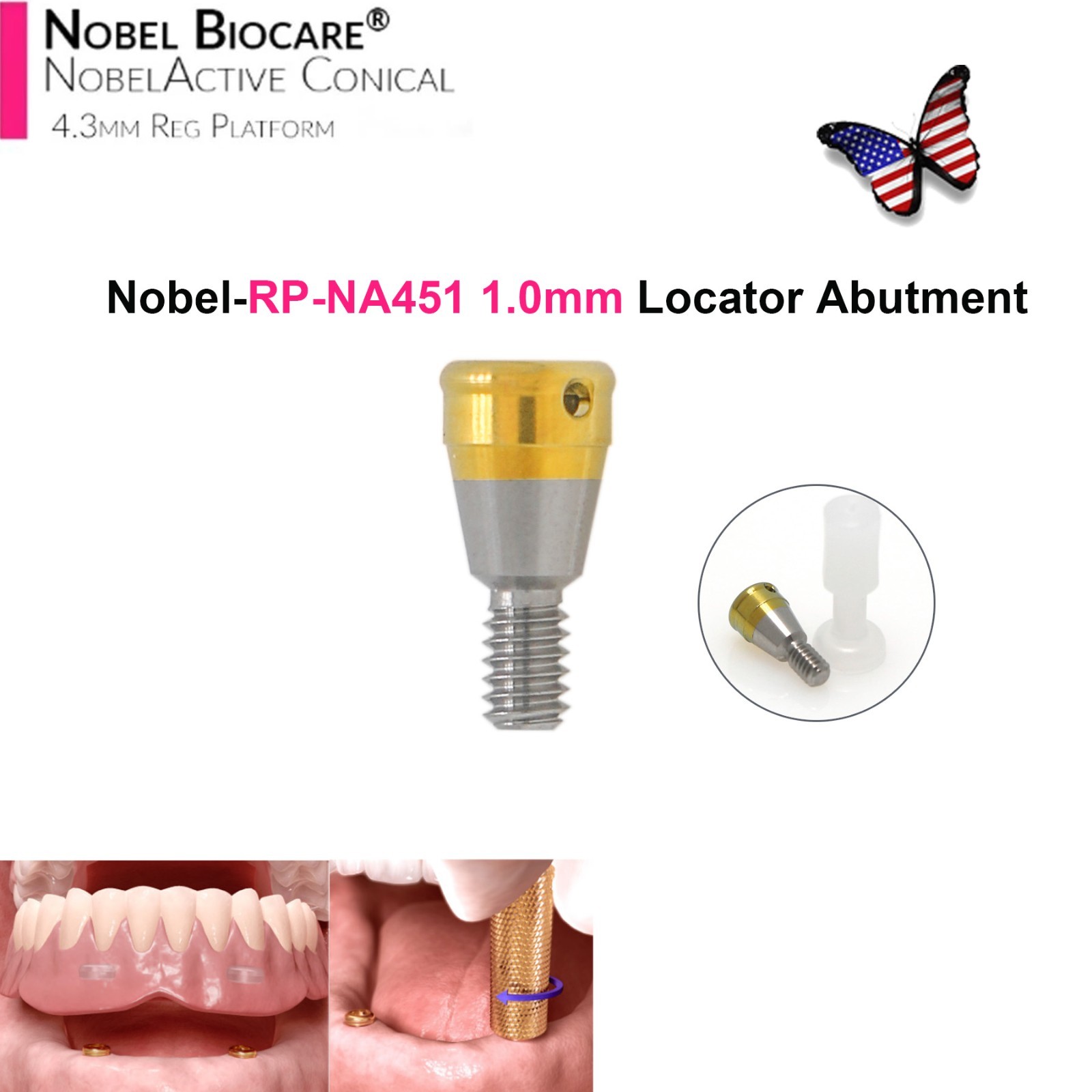 Dental Locator Abutment NP RP Compatible with Nobel NBL Active Implant AH 1–5mm