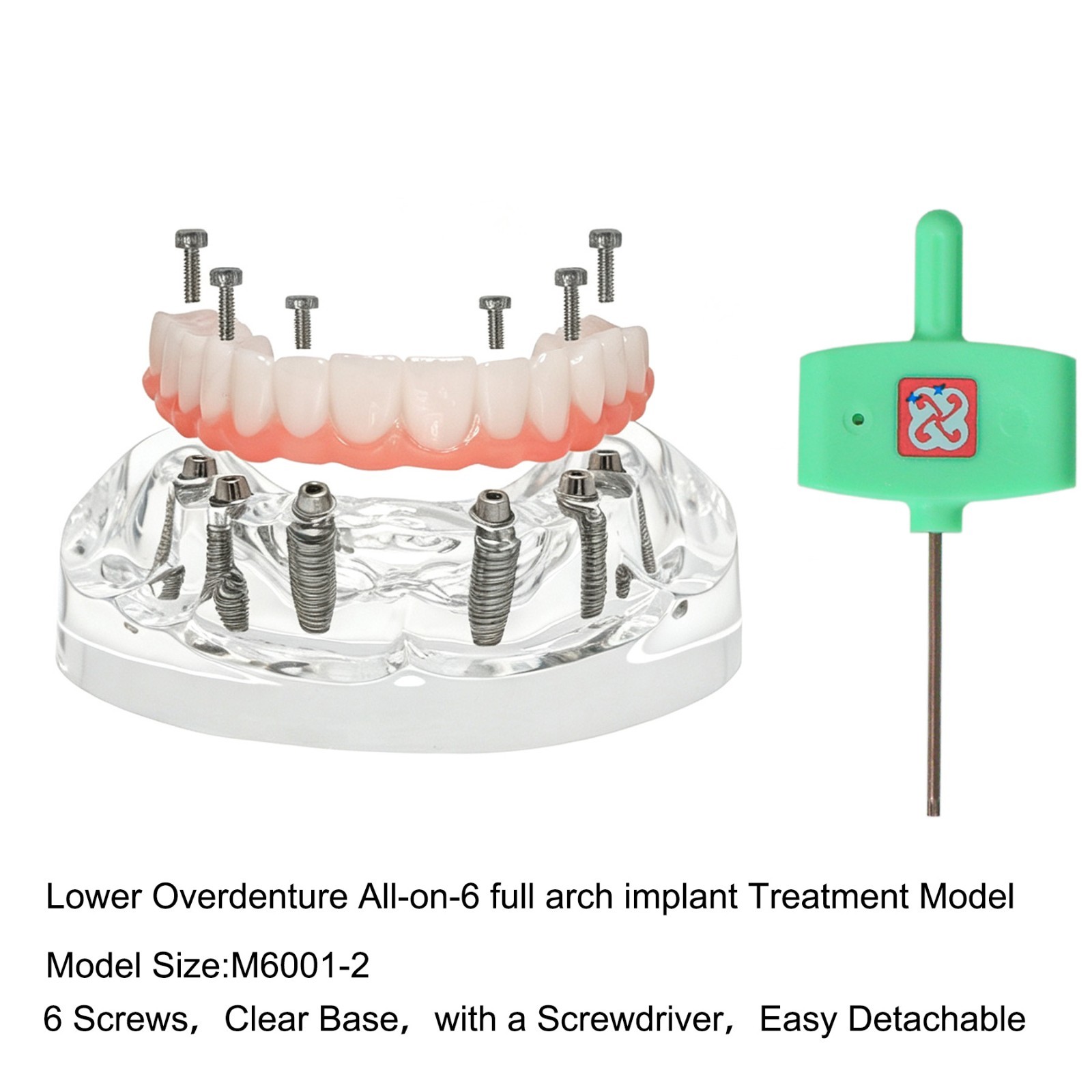 Clear Base Detachable All-on-4 /All-on-6 Overdenture Dental Implant Study Model