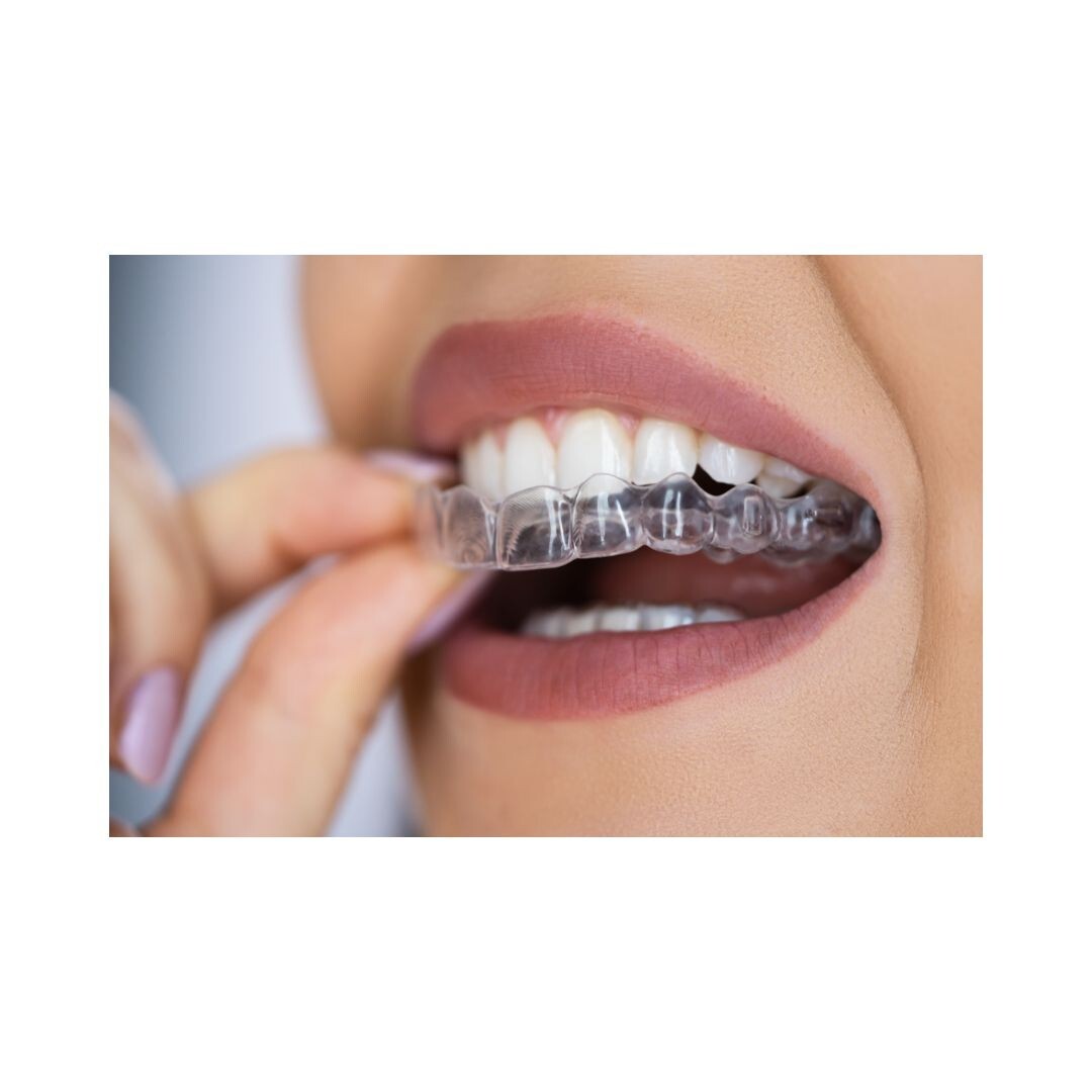 GuardPro Dental Night Guard Resin – Biocompatible, Clear, 3D Printing Splints
