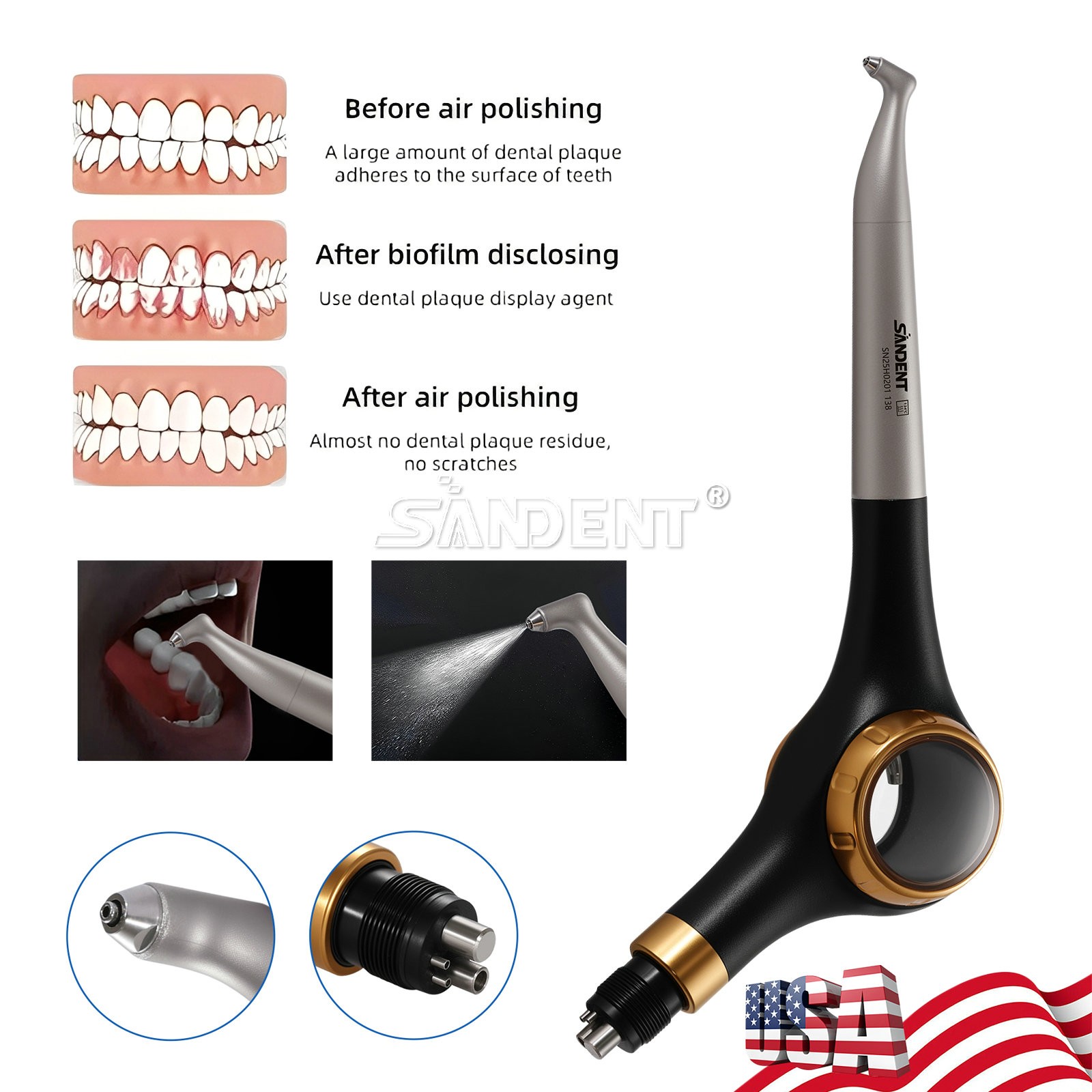 SANDENT Dental Air Polisher Supragingival Handpiece dt