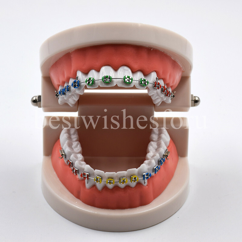 1*Dental Orthodontic Standard Teeth Tooth Model Metal Brackets & Ligature Ties