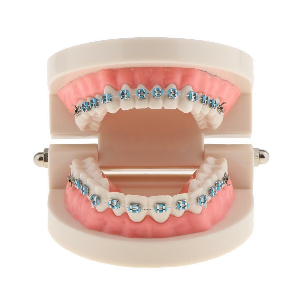 Dental Metal Model Orthodontic Adult Standard Teeth Hoop Brackets Ligature Tie