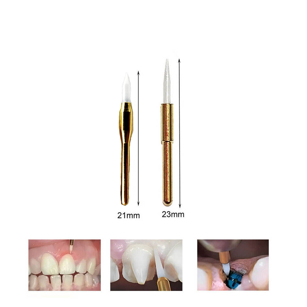 Dental Surgical Ceramic Soft Tissue Trimmer 21/23mm for Gingival Retraction