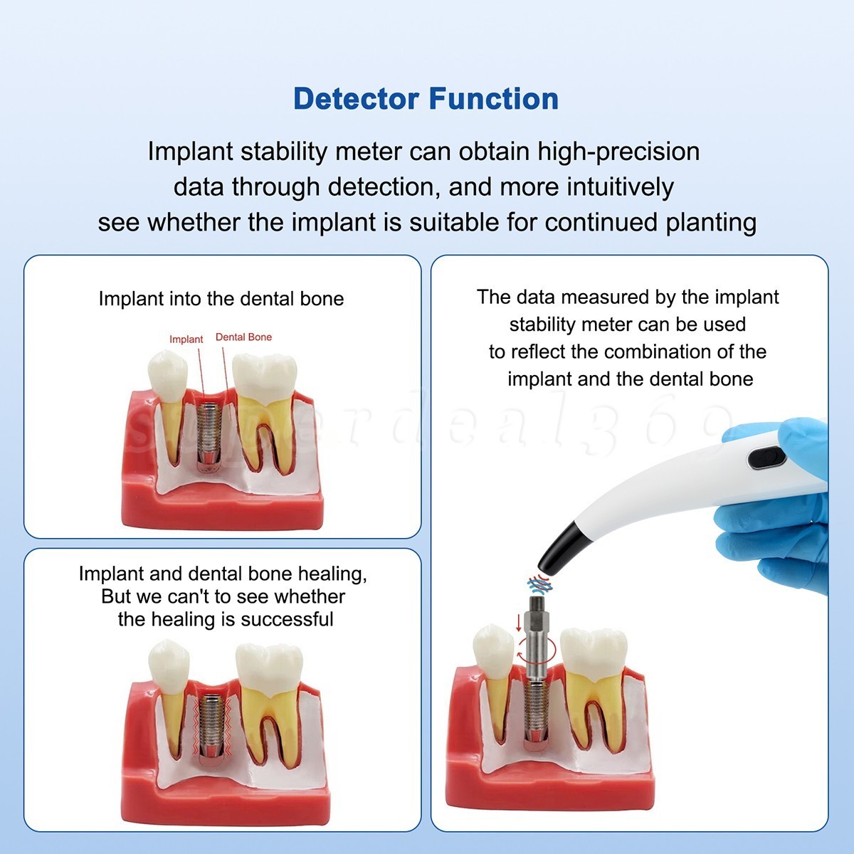 Dental ISQ Osseointegration Implant Stability Meter Measurement Tester Monitor