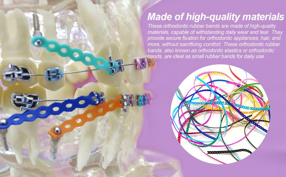 24 Pieces Colorful Power Chain Set (Continuous) for Braces, Fashion colorful