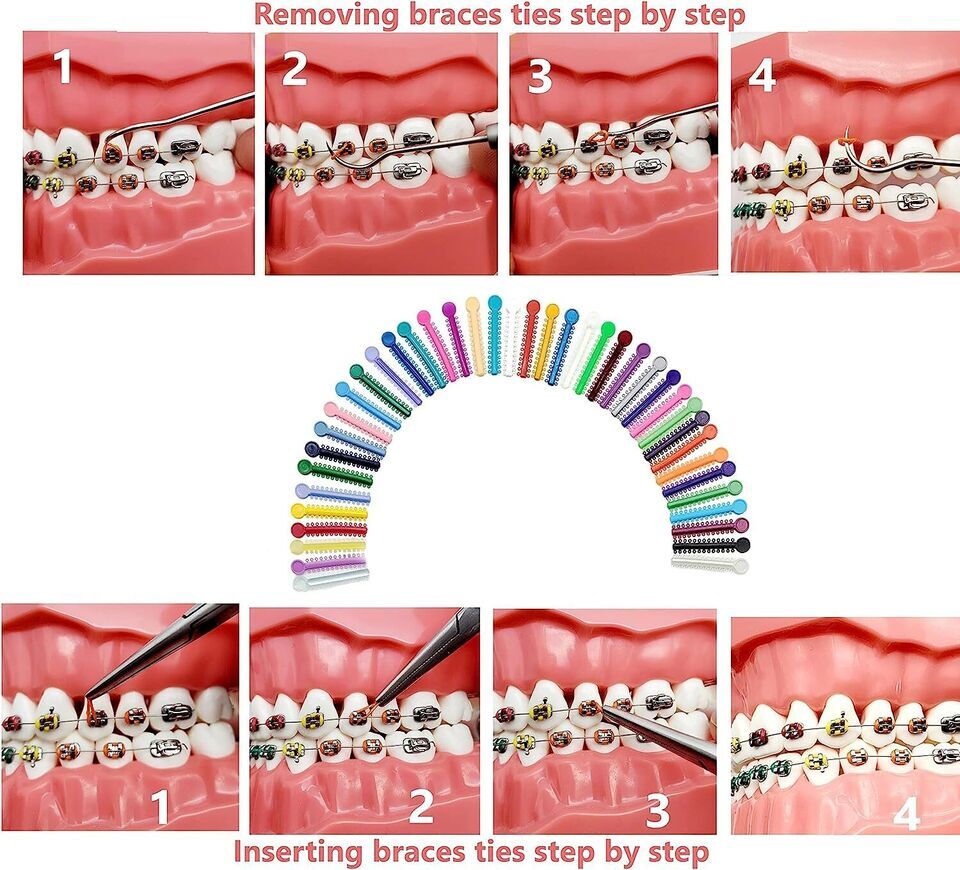 1040pcs Dental Orthodontic Ligature Ties Braces Elastic Rubber Bands ORA