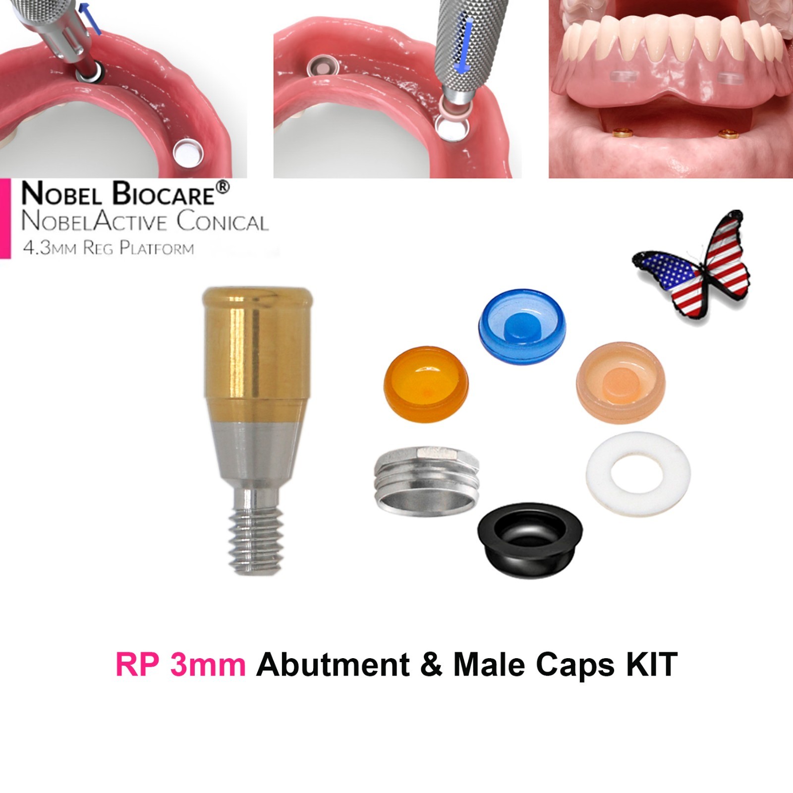 US Implant Nobel Active NP Ø3.5mm Locator Abutments PEEK Overdenture Male Cap