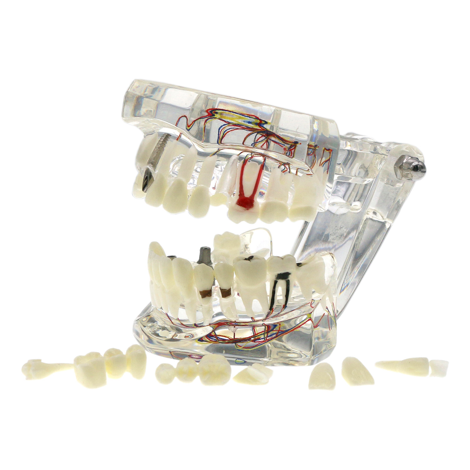 Dental Oral Typodont Model Implant Pathological Removable Teach Visible Anatomy