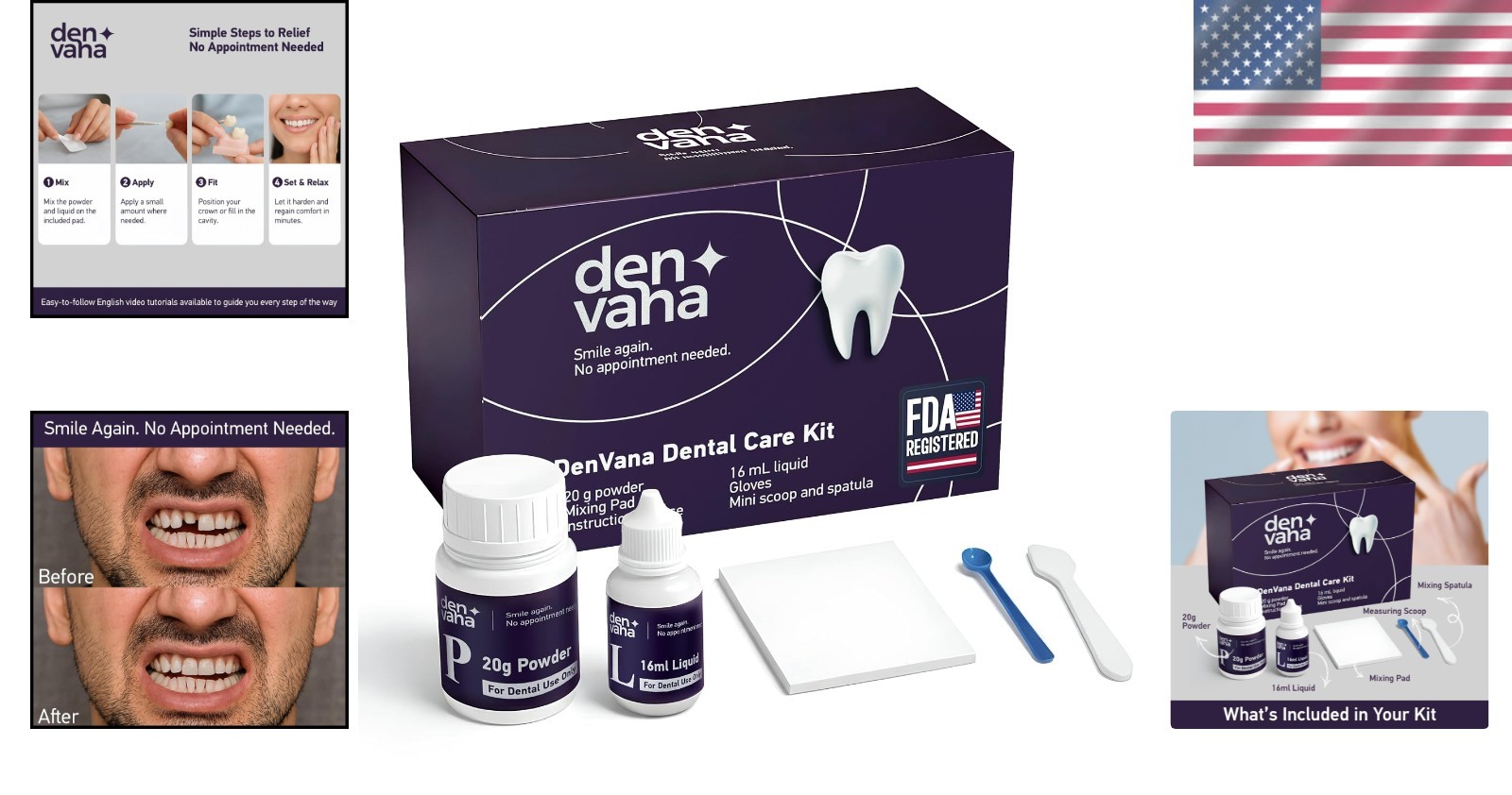 Professional Dental Cement Kit – Secure Solutions for Broken Crowns & Loose Caps