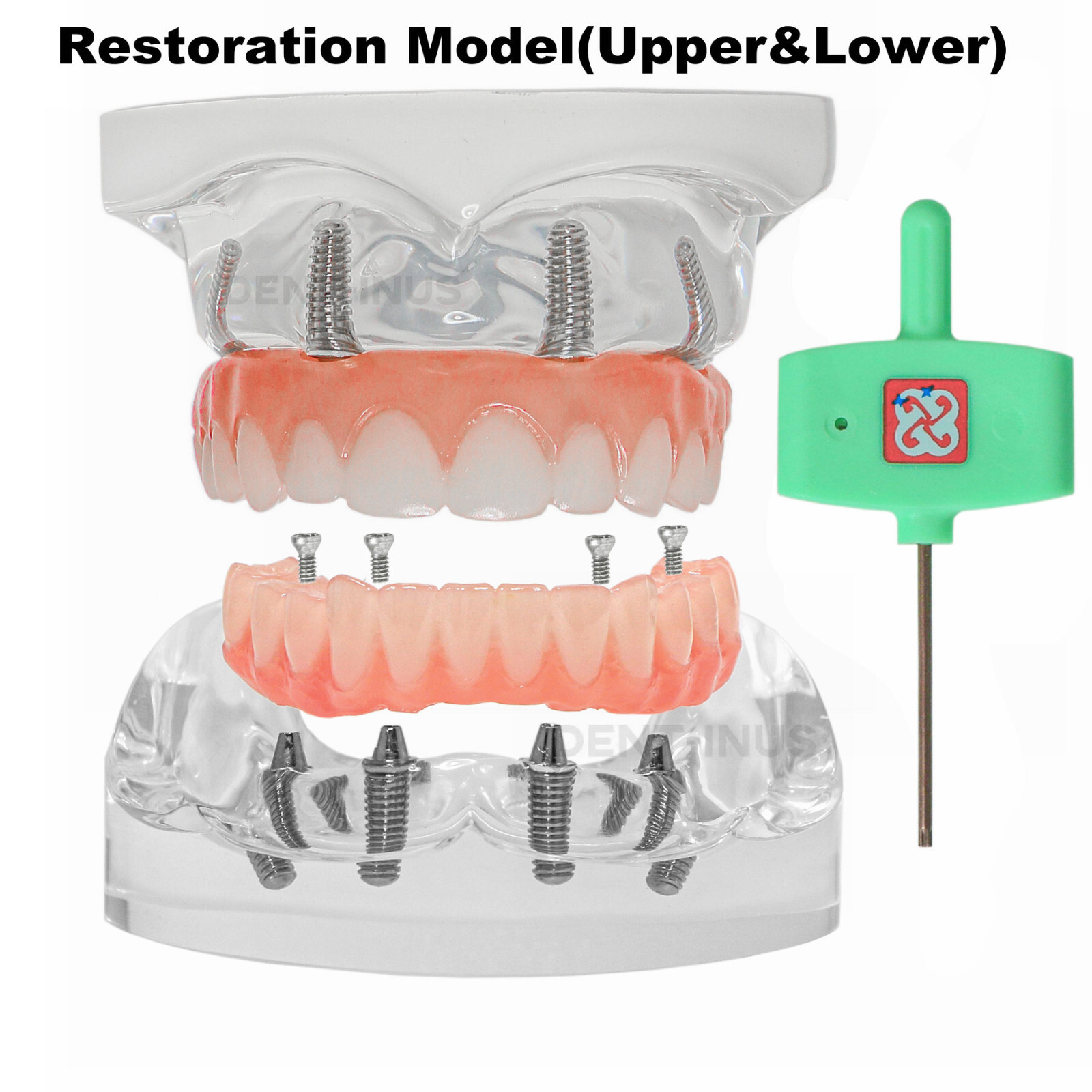 Dental 4 Implants Demo Implant Teeth Model Restoration Overdenture Upper/Lower