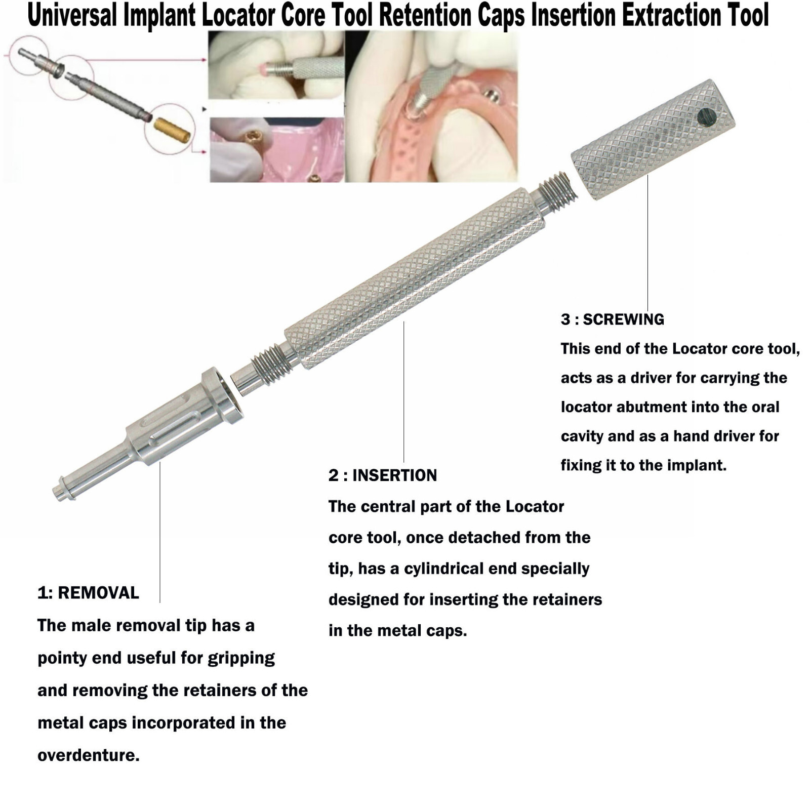 Implant Locator Core Tool Retention Caps Insertion Extraction Tool Silver Dental