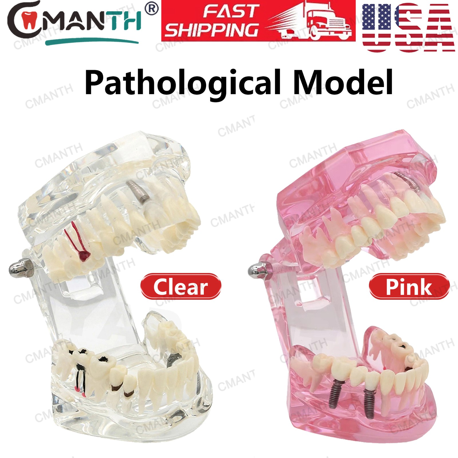 US Dental Teeth Model Implant Periodontal Disease Suture Drilling Training Demo