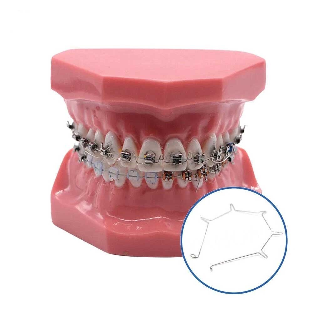 Dental Orthodontic Anterior Root Torquing Auxiliary Arch 5Pcs/Pack All Size