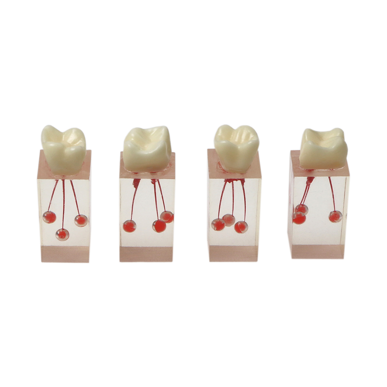 10Pcs Dental Endo Root Canals Teeth Model Practice Block RCT Pulp Cavity Study