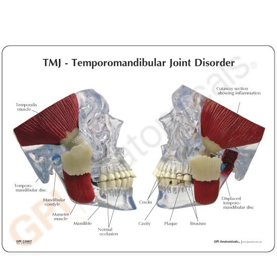 TMJ Temporomandibular Jaw GPI Model LFA #2880. Make Us an Offer! SEE VIDEO
