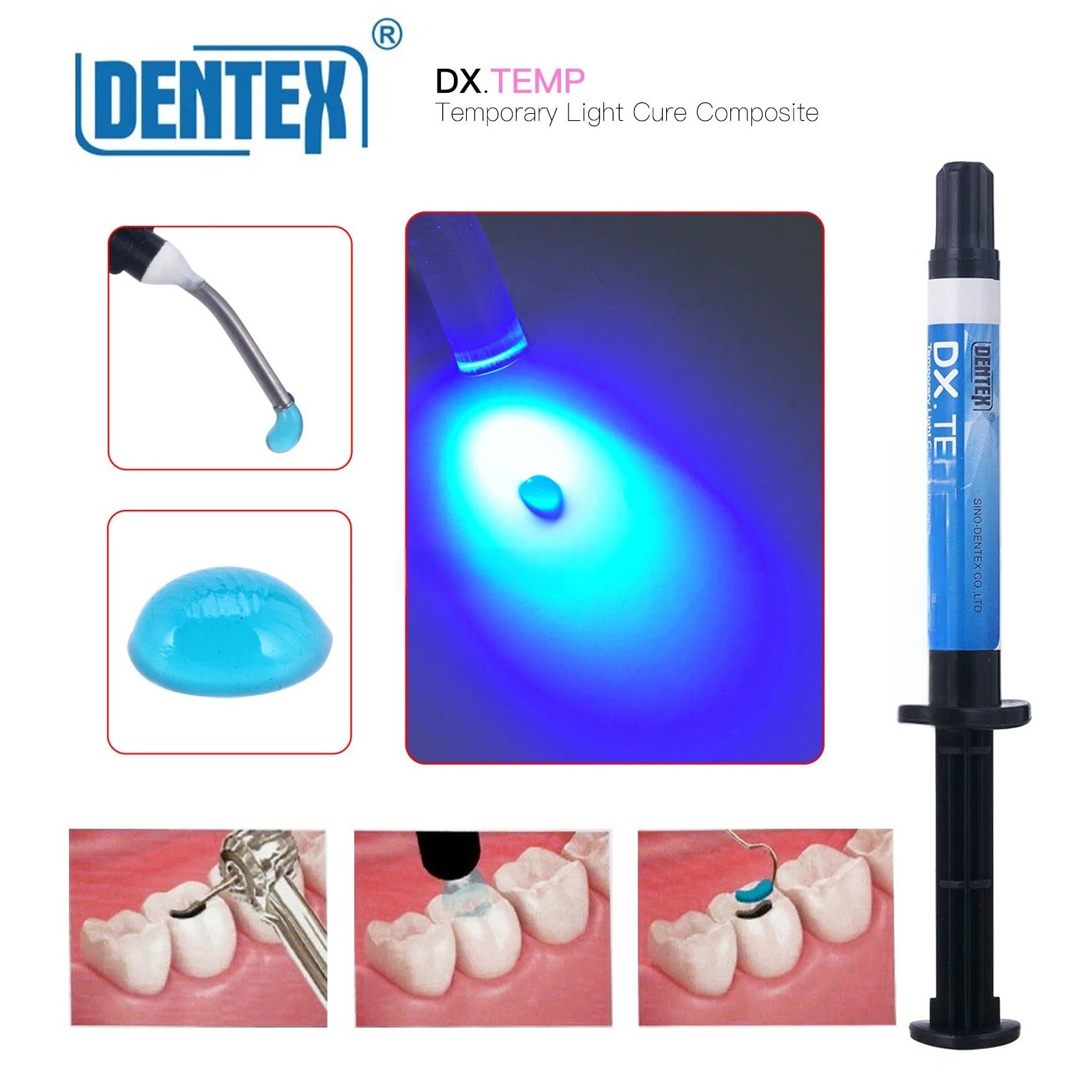 Dentex Dental Temporary Flow Light Cure Filling Composite Resin Blue