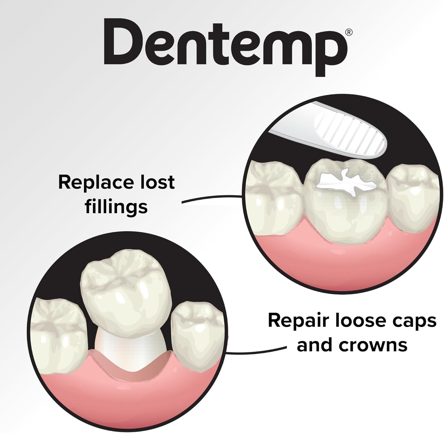 Maximum Strength Dental Repair Kit – Instant Pain Relief for Lost Fillings