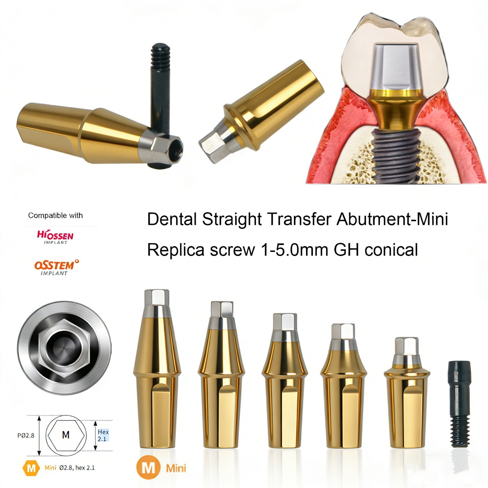US Titanium Straight Dental Abutment Mini Regular Hex Fit Hiossen ET TS Implants