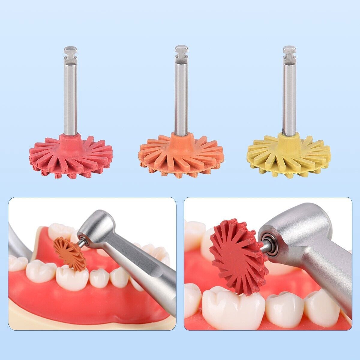 AZDENT Dental Composite Polishing Wheel RA 2.35mm Coarse Medium Fine Polisher