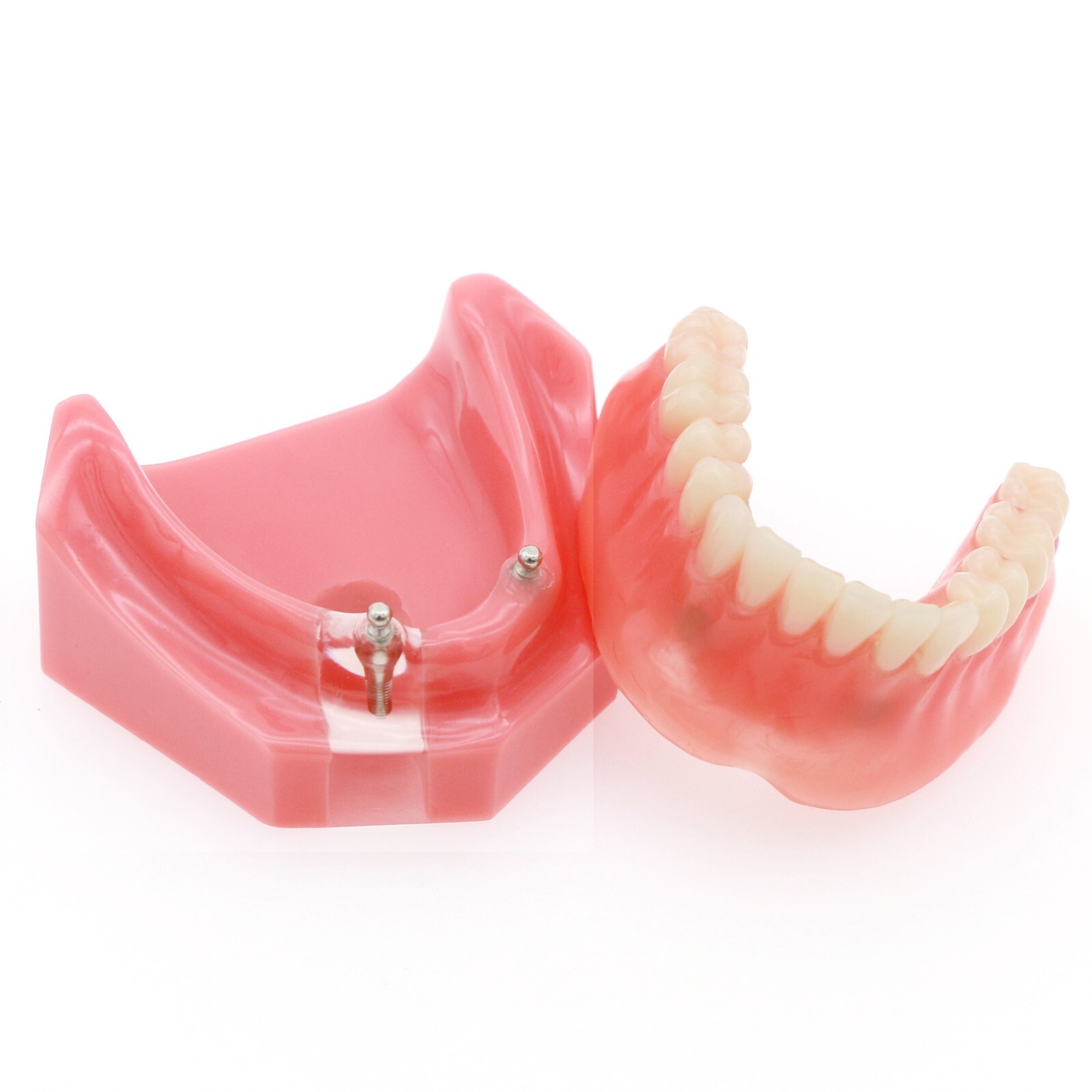 Dental Typodont Teeth Model Ortho Implant Pathological Perio Practice Demo Model