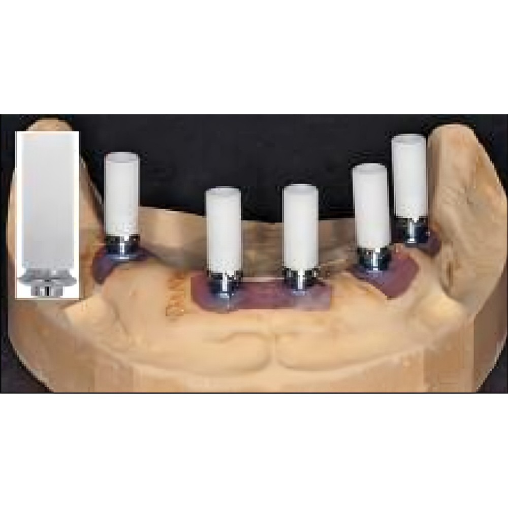 Adin NP Engaging Plastic Cylinder Casting Abutment 3.7mm x GH 0.7mm x 11mm (NP00