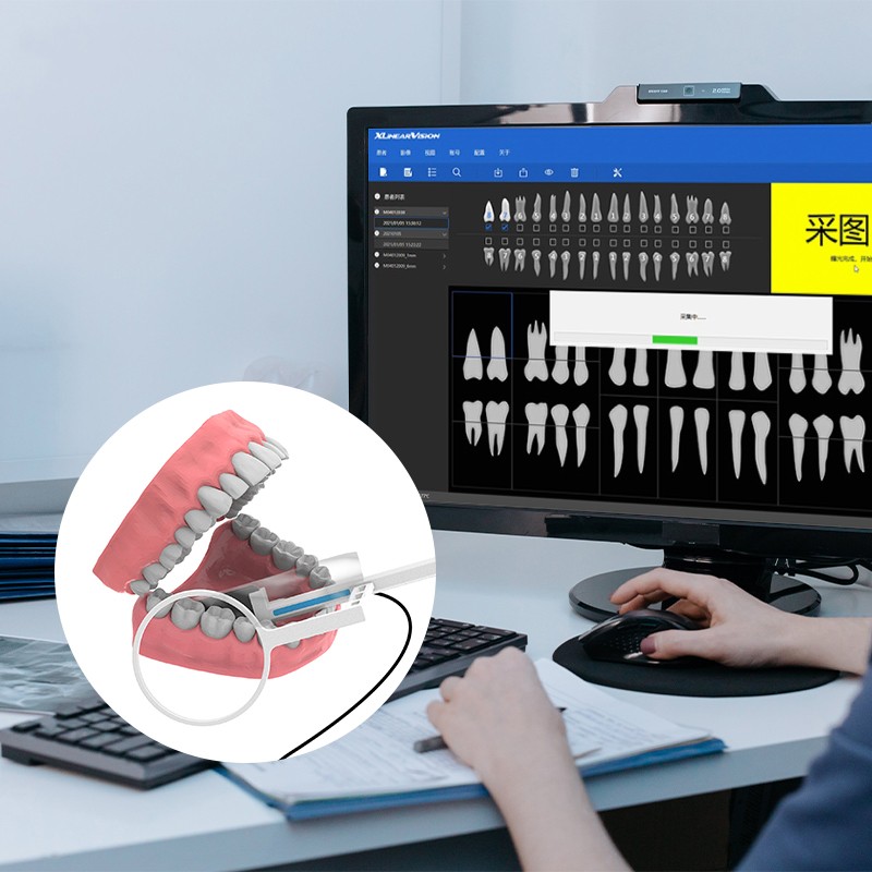 1 Year Warranty Dental RVG Sensor High-Frequency Digital Sensor Dentist HD Image