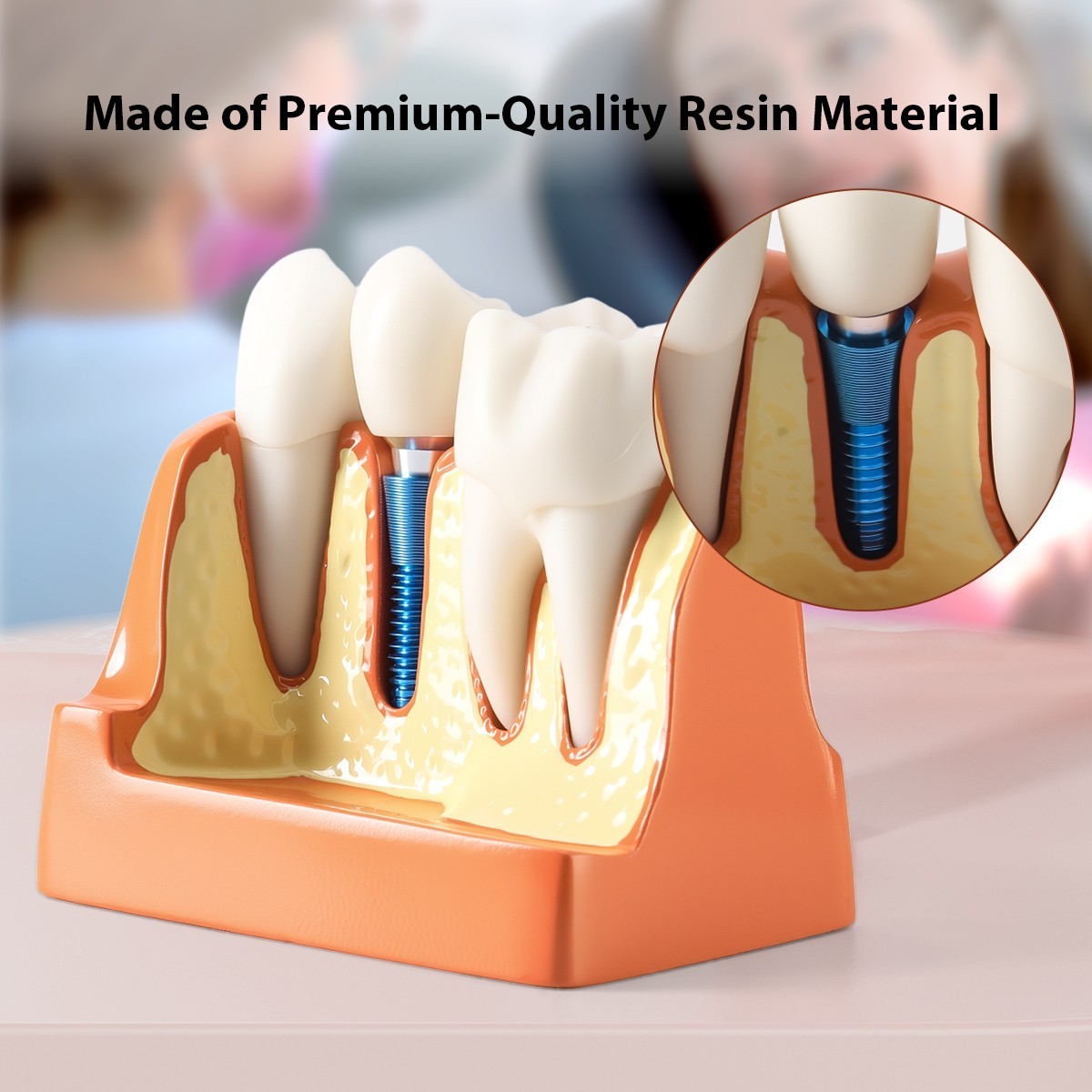 Dental 4 Times Teeth Model Implant Analysis Crown Bridge Demonstration Removable