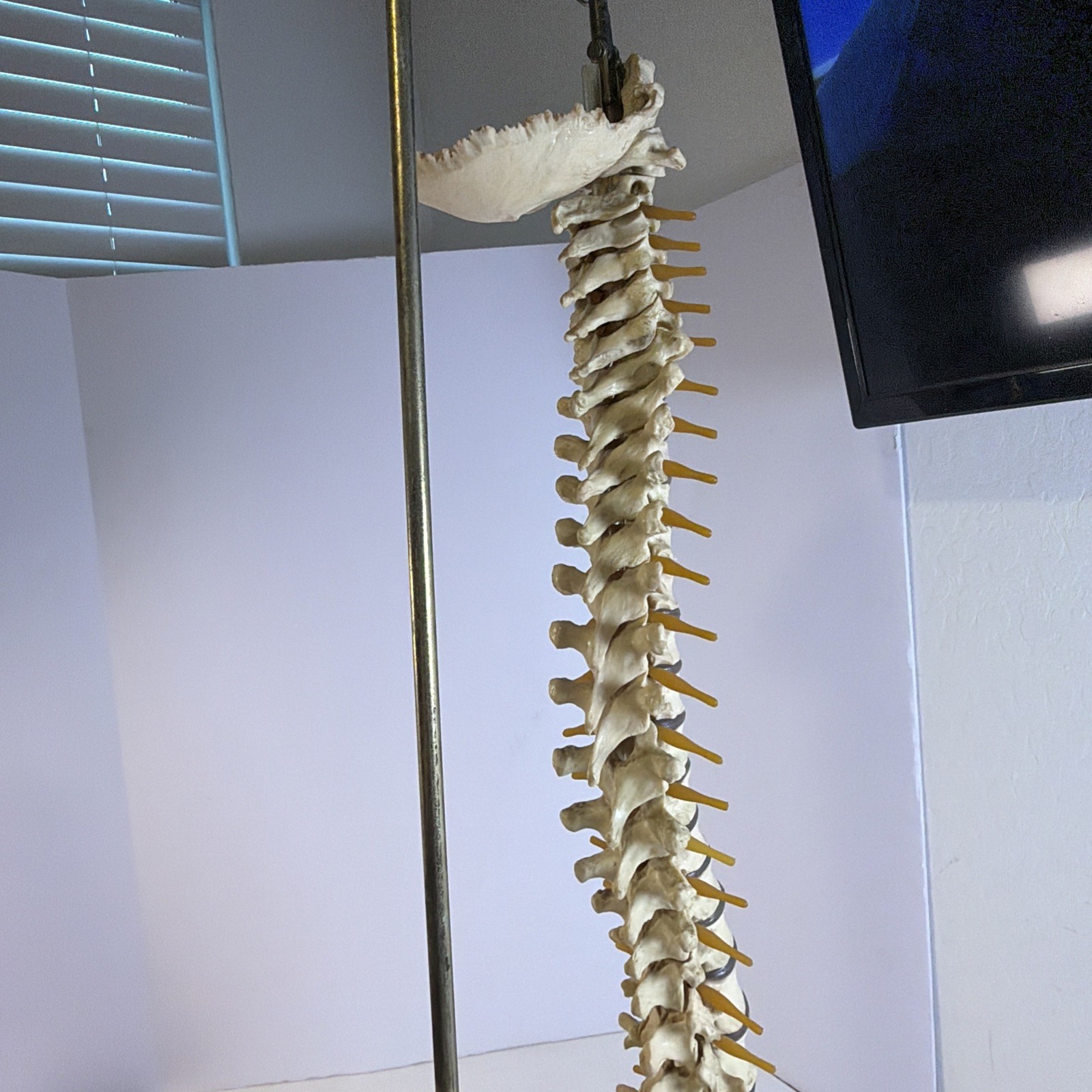 Vintage ORTHOFLEX Human Pelvis Vertebrae Skull Base Spinal Nerve Cord Spine