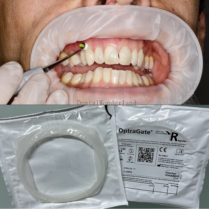 10Pcs Ivoclar Optragate Dental 3D Lip Cheek Retractor Mouth Opener Regular Adult
