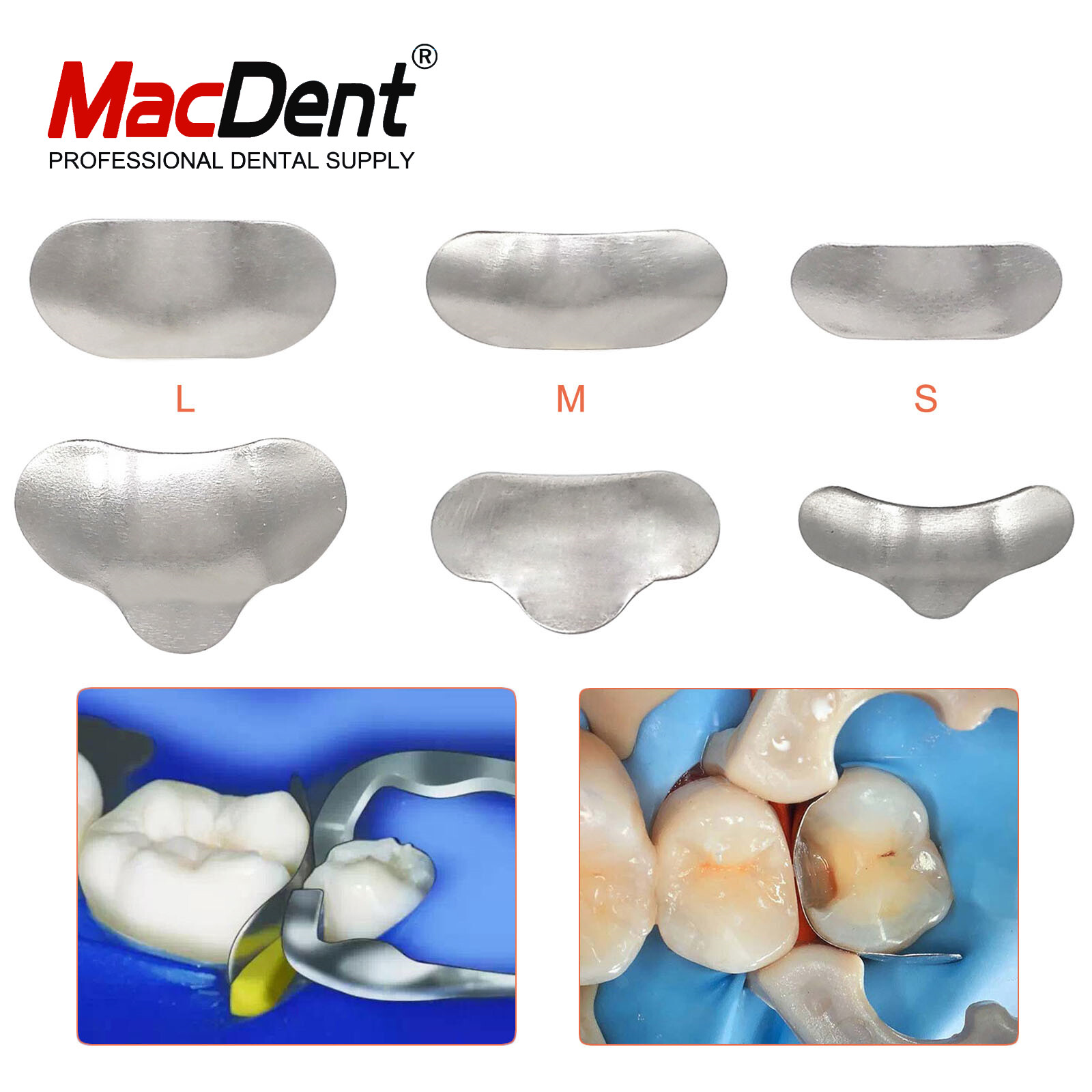 50Pcs/Box Dental Matrices Bands Metal Matrix Band Sectional Contoured Refill Box