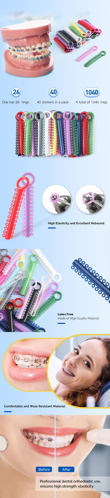 JMU Dental Orthodontic Ligature Ties Elastic Latex Bands 1040pcs/pk Multi-Color