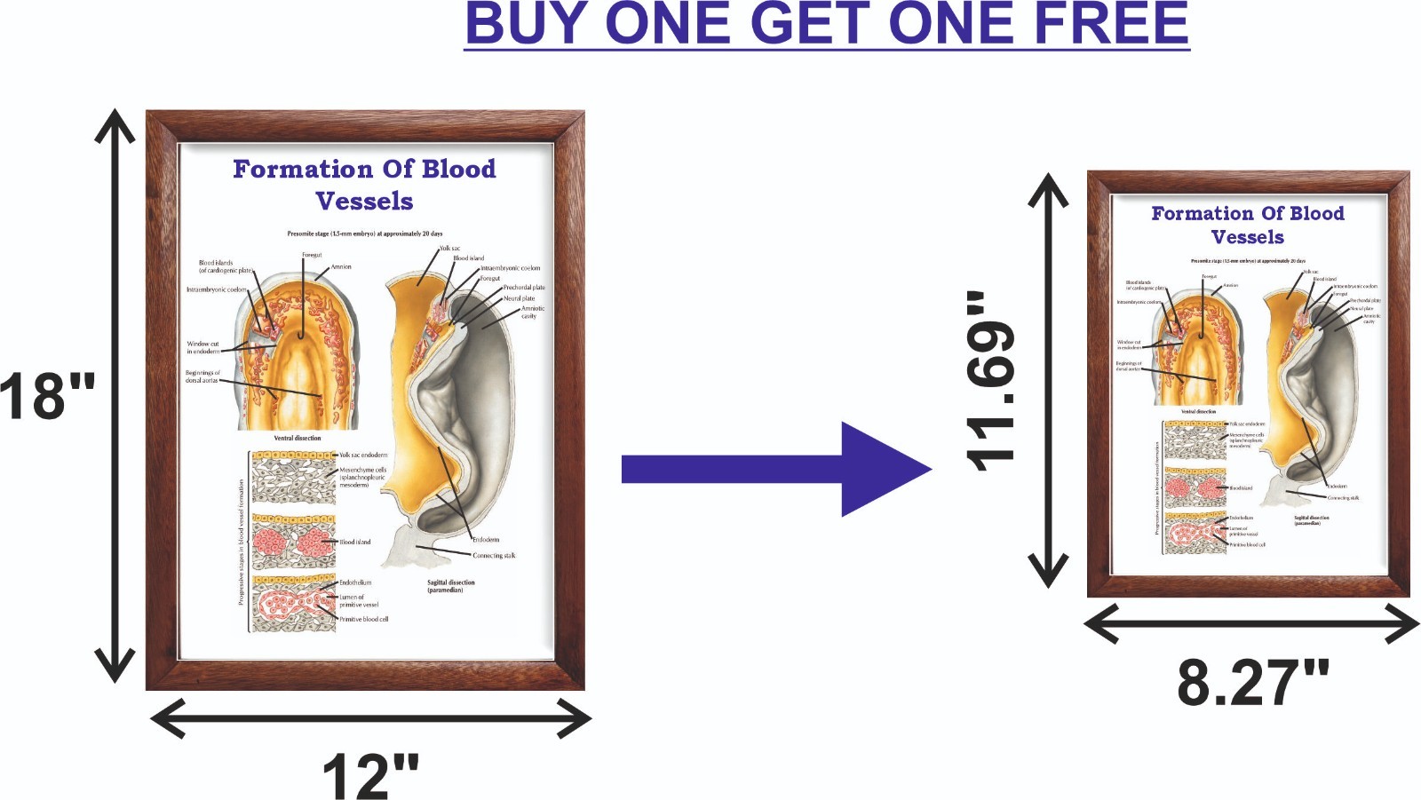 Formation Of Blood Vessels Chart 12×18 inches