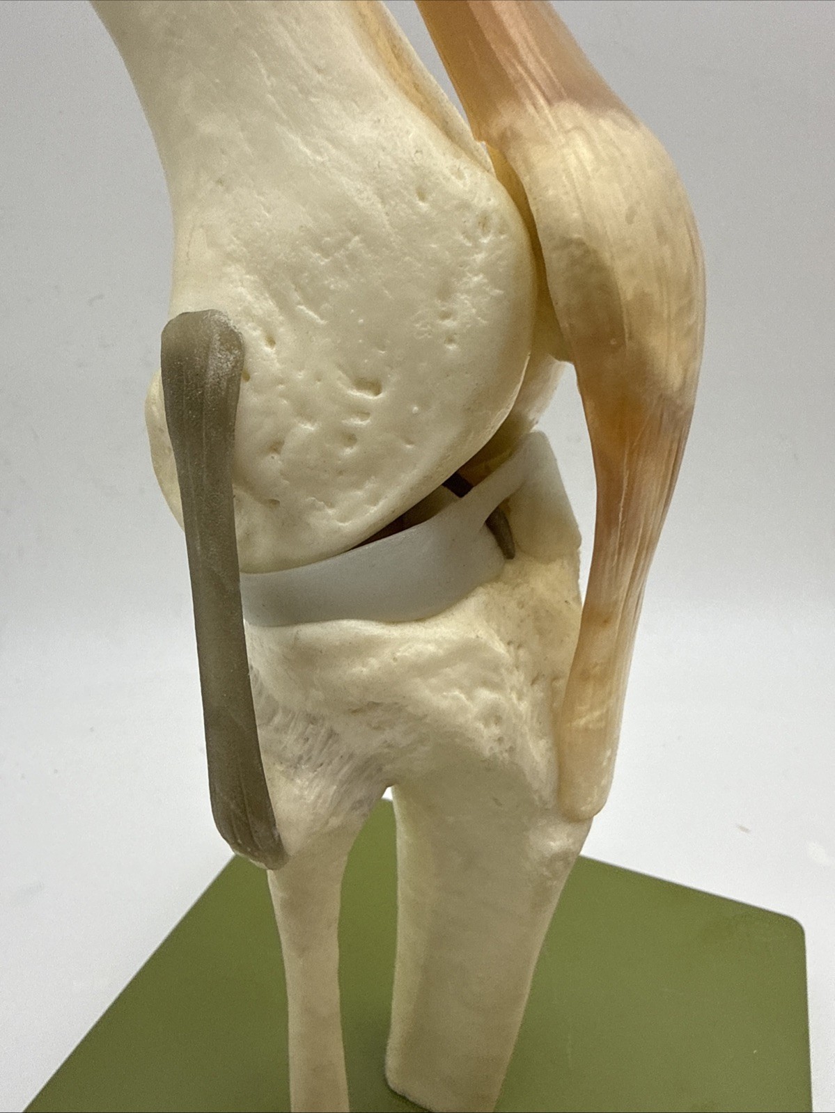 Somso NS50 Functional Knee Joint with Ligaments Anatomical Model NS 50