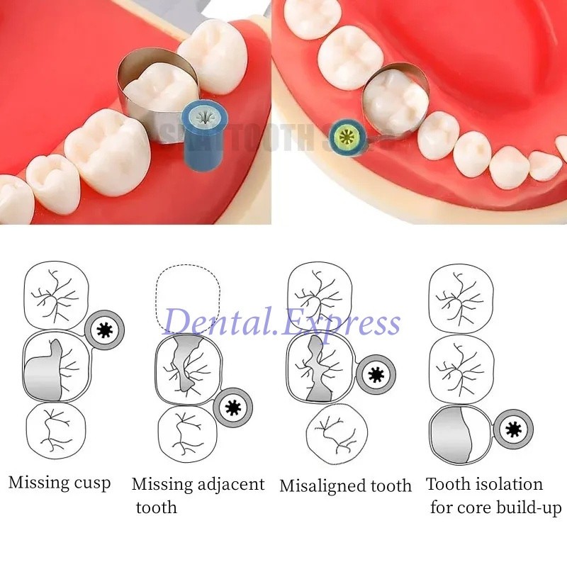 50Pcs/Box Adapt SuperCap Dental Steel Matrix Reel Matrices Thickness 0.030/0.038