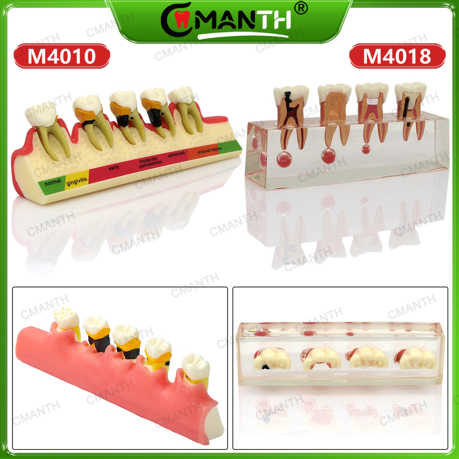 Multiple Types Dental Teeth Model Ortho Implant Practice Teaching Demo Model