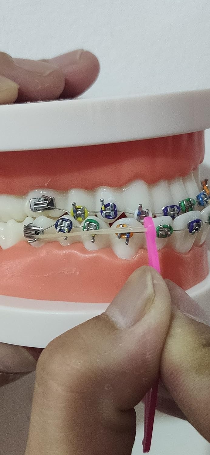 15PCS Rubber Bands Placers for Braces – Non-Toxic & Frustration-Free