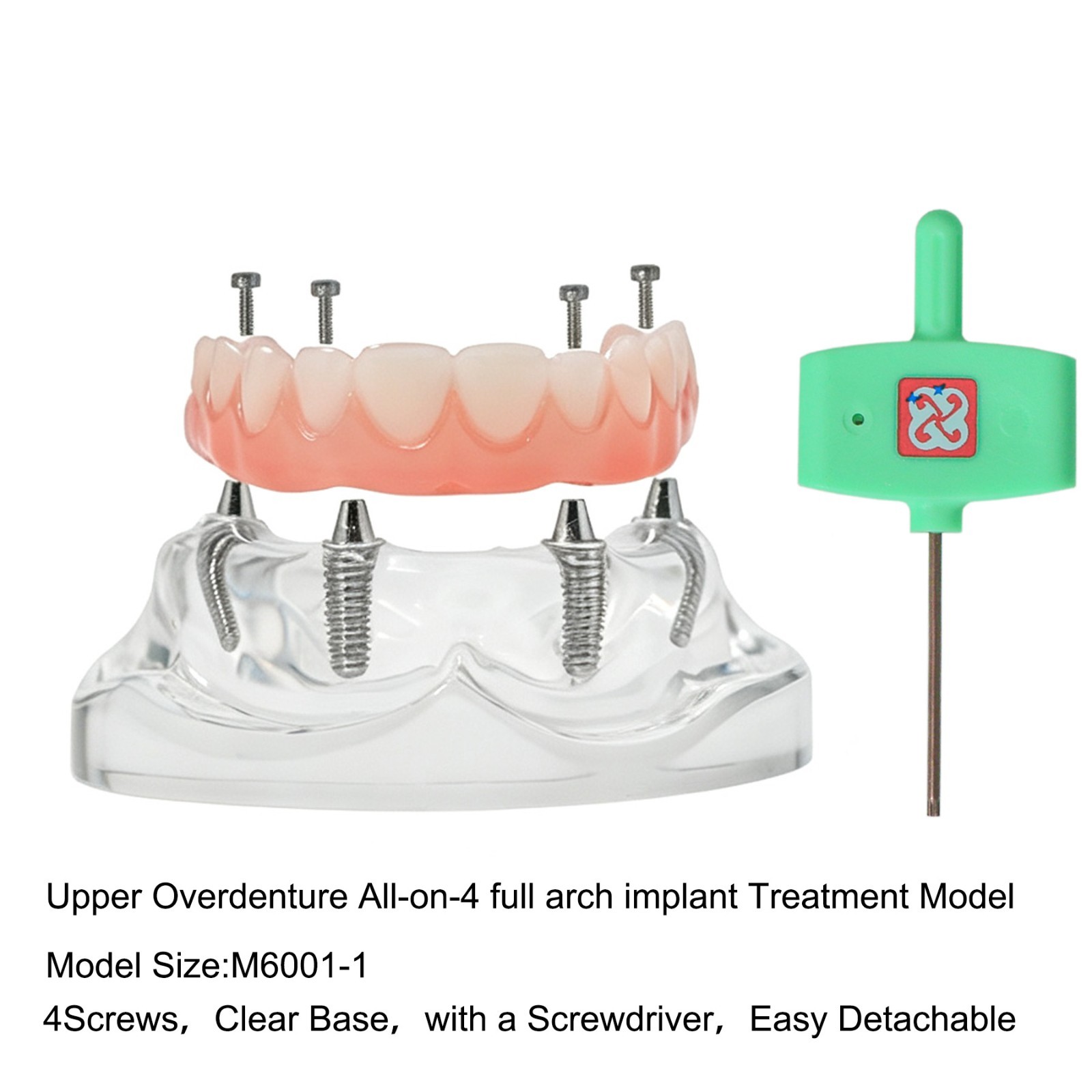 Clear Base Detachable All-on-4 /All-on-6 Overdenture Dental Implant Study Model