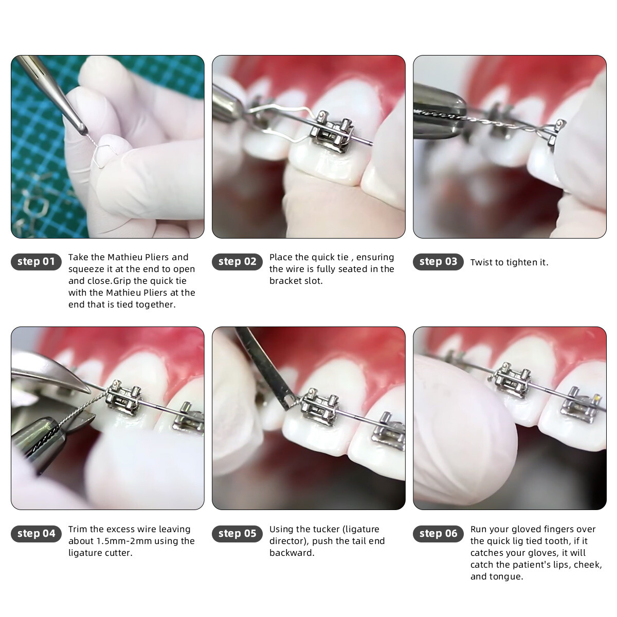 AZDENT Dental Orthodontic Wire Preformed Ligature Ties Short Twist Wires
