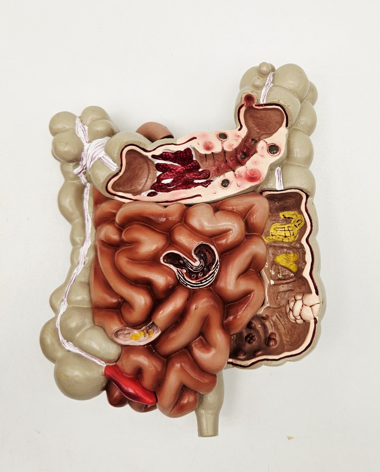 GI Tract Anatomy Model Handpainted Medical Display Gastro Intestinal Display
