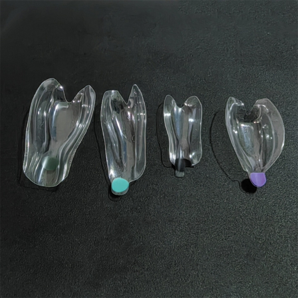Clear Matrix Band Transparent Bow Matrices Dental Anterior Front Teeth Posterior