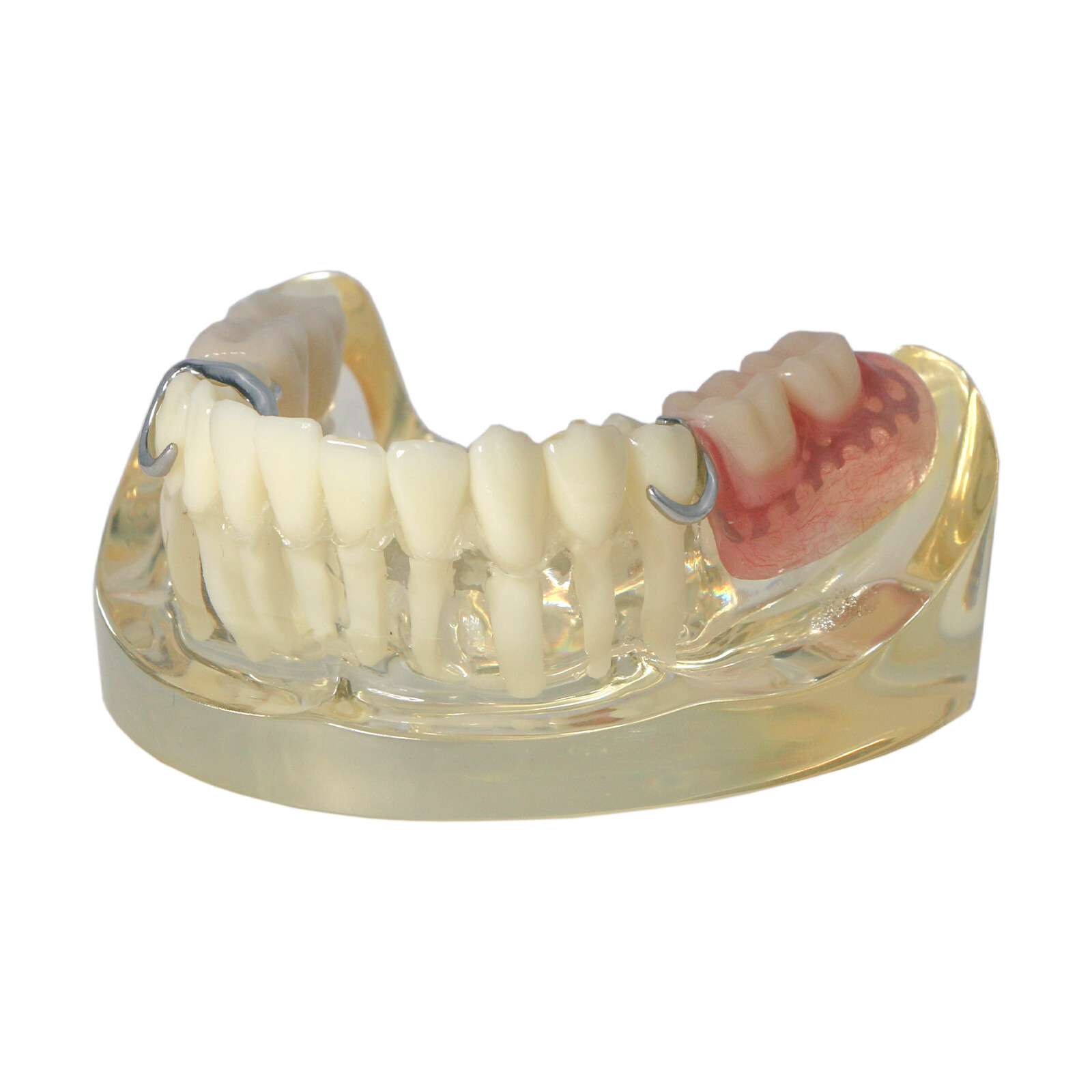 Dental Restoration Implant Typodont Teeth Model with Partial Denture M6022