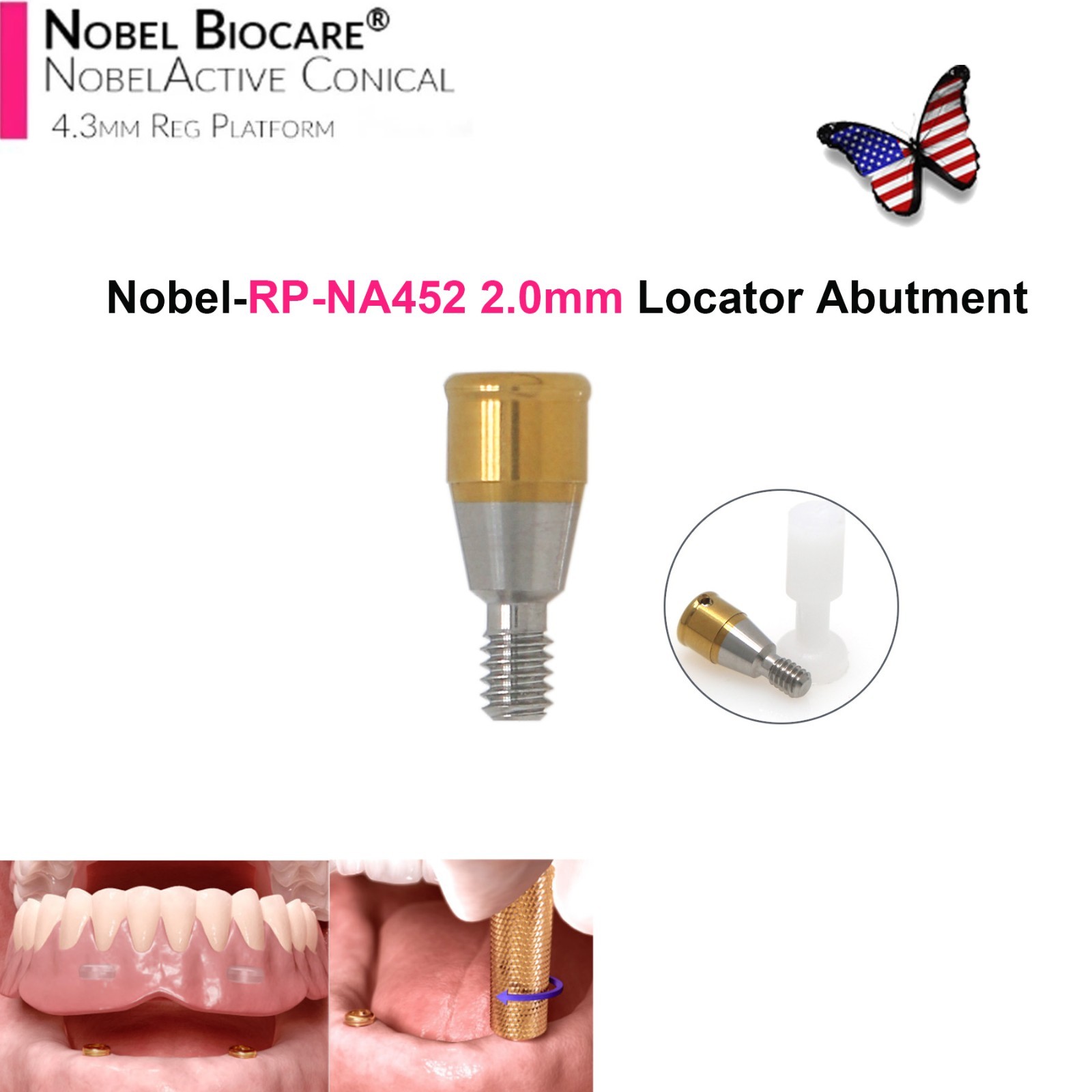 Dental Locator Abutment NP RP Compatible with Nobel NBL Active Implant AH 1–5mm