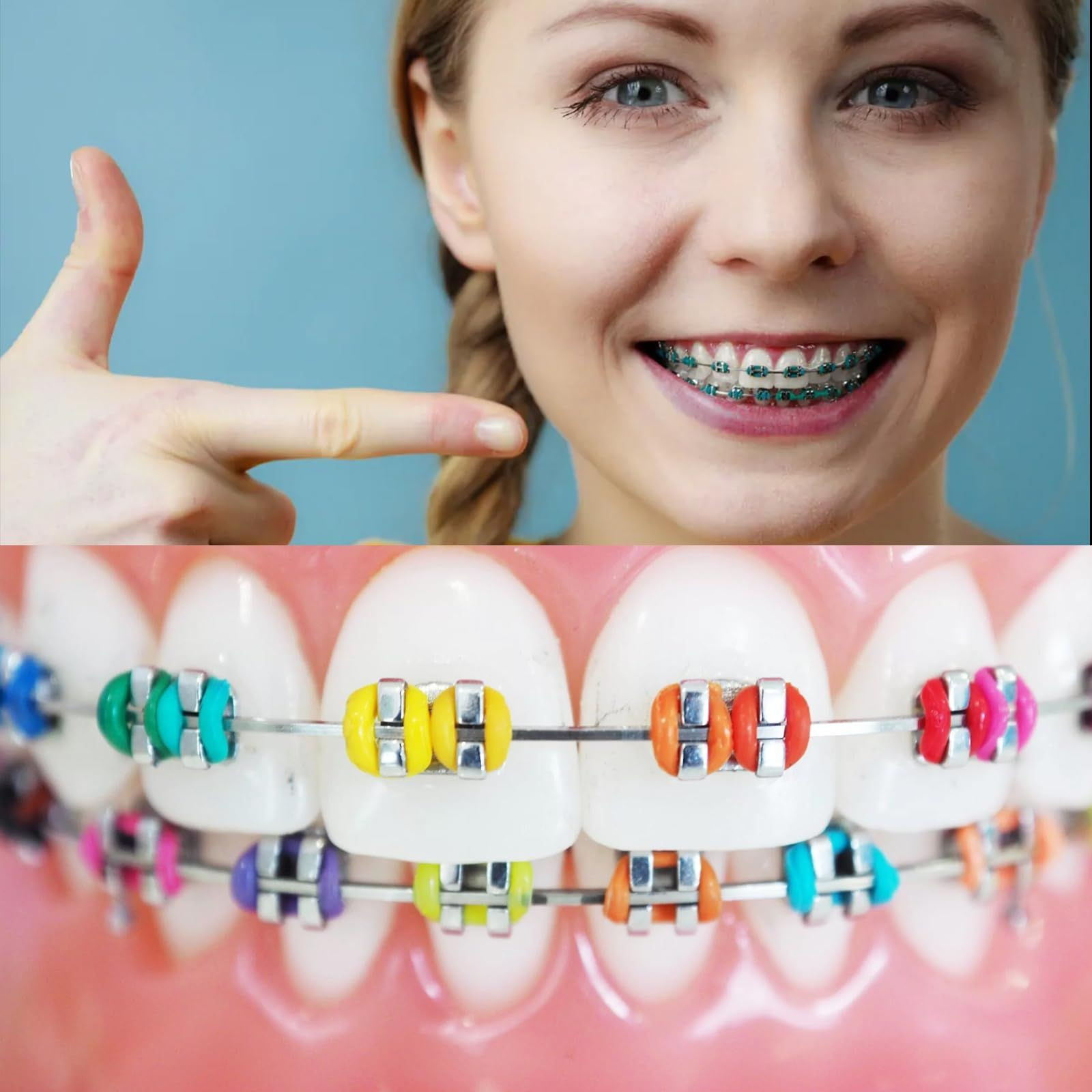 1040 Pcs Multi-Color Rubber Bands, Orthodontic Ligature Ties Kit Multi Color