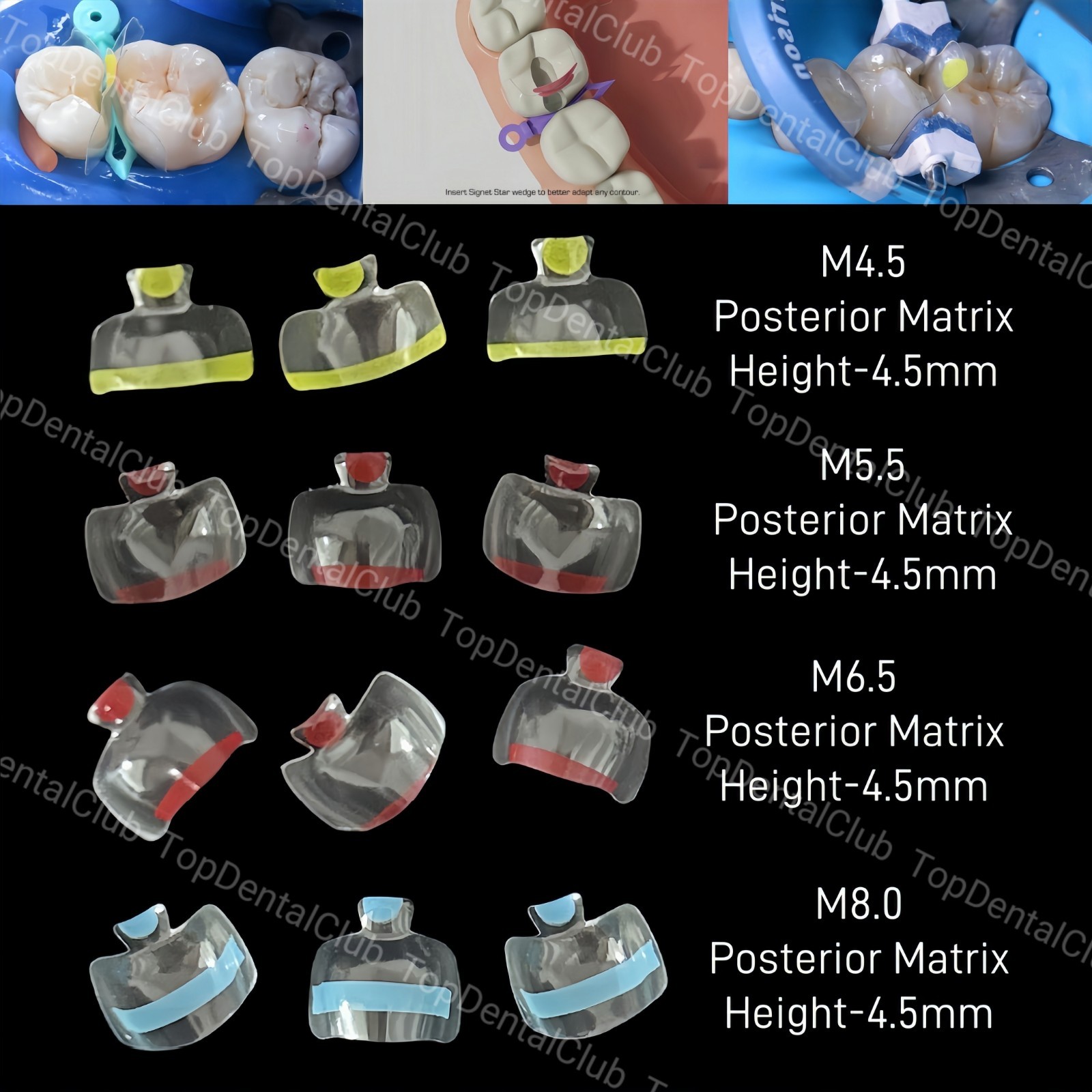 Clear Matrix Dental Anterior Posterior Transparent BT Matrices Fit BioClear