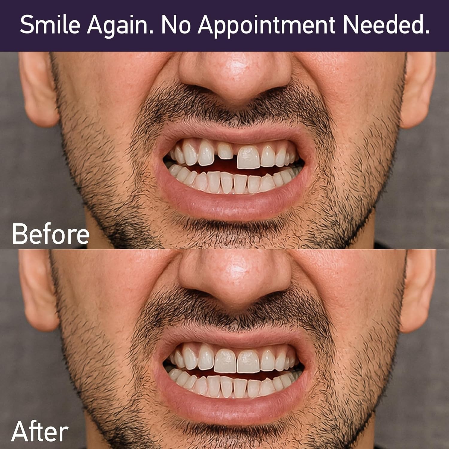 Dental Cement Kit – Zinc Oxide Eugenol Temporary Filling & Crown Repair | Too…