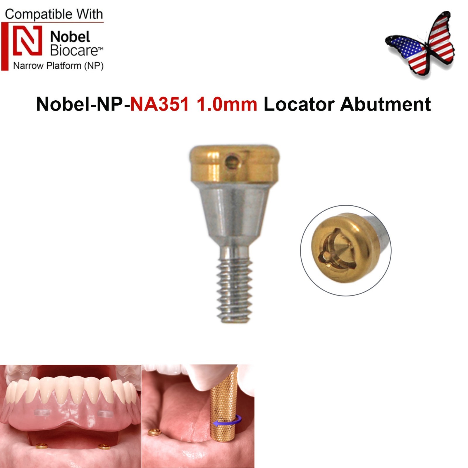 Dental Locator Abutment NP RP Compatible with Nobel NBL Active Implant AH 1–5mm